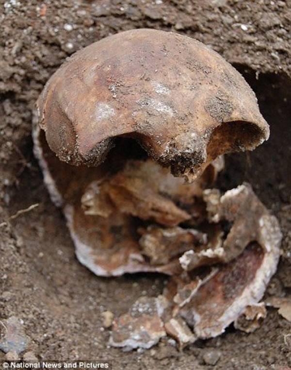 英国花园埋尸案：英国民宅中挖出132年前的人类头骨
