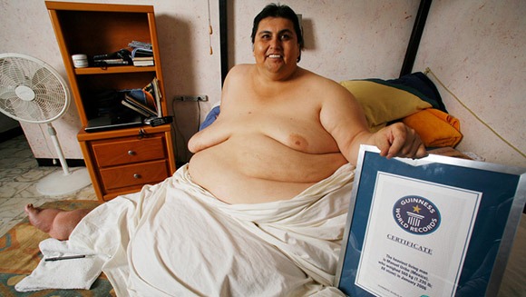 世界上体重最重的人有多少斤：曼努埃尔就重达560公斤