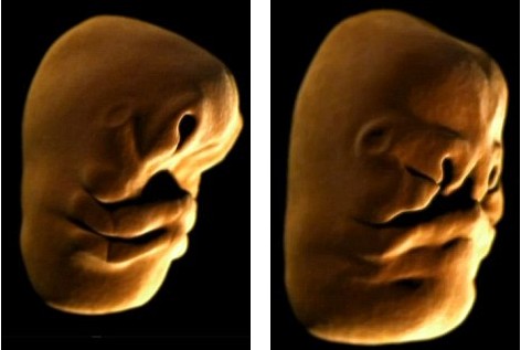 人类胎儿的脸部形成过程：胎儿的形成全过程震撼