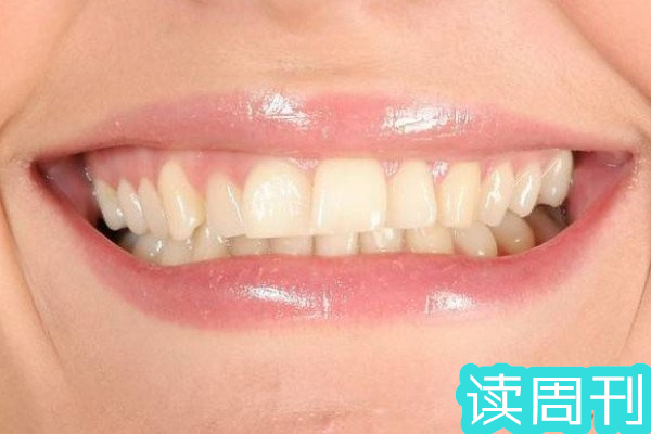 上牙宽下牙窄的人的命运(牙齿好坏会直接影响人寿命)(1)