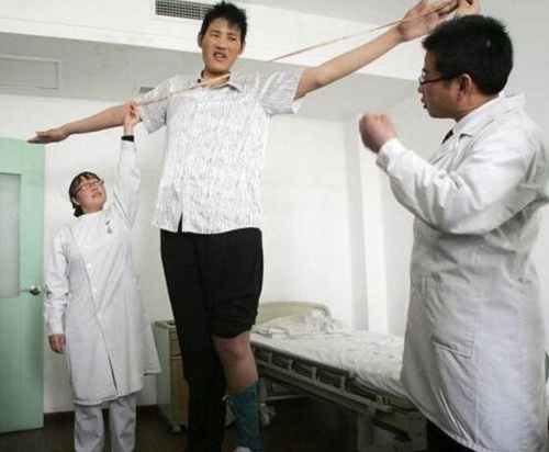 盘点十大世界上最高的人（詹世钗3.19米真实身高2.4米）(5)
