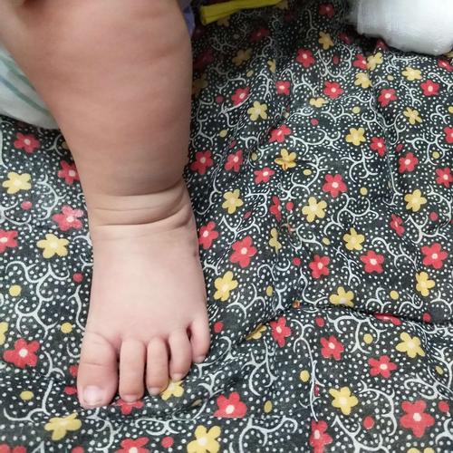 幼儿正常脚型
