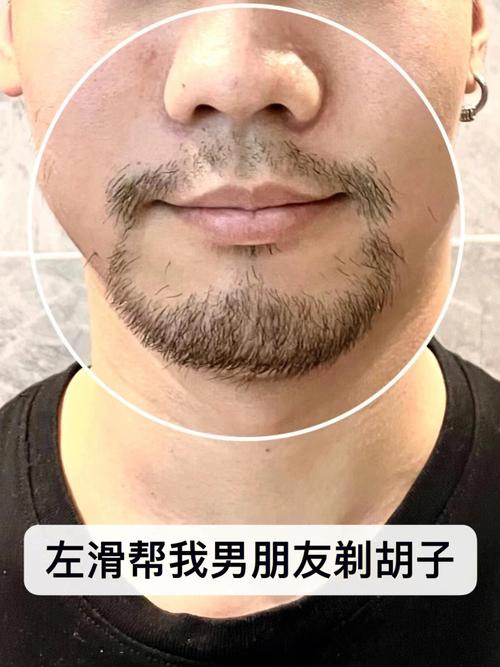 为何胡子每天刮还是长得快(1)