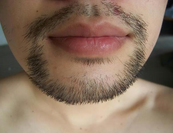 为何胡子每天刮还是长得快(2)