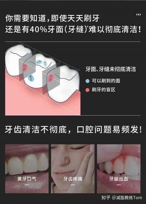 怎样才可以去除牙齿上的黑色污垢(1)