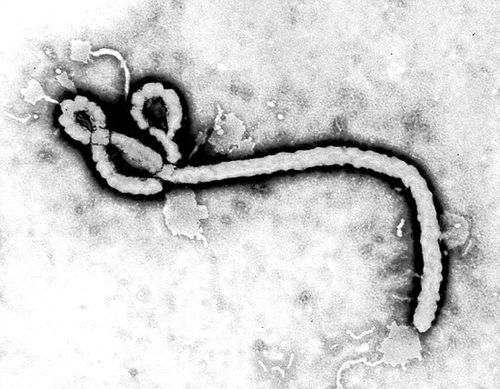 伊波拉病毒真的存在吗(4)