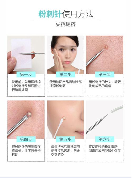 粉刺针的正确使用方法(1)