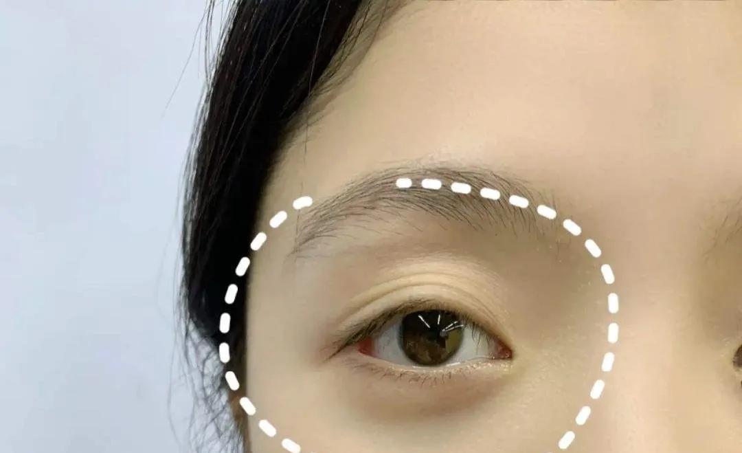如何淡化黑眼圈有效方法（怎么快速消除黑眼圈最有效）(2)