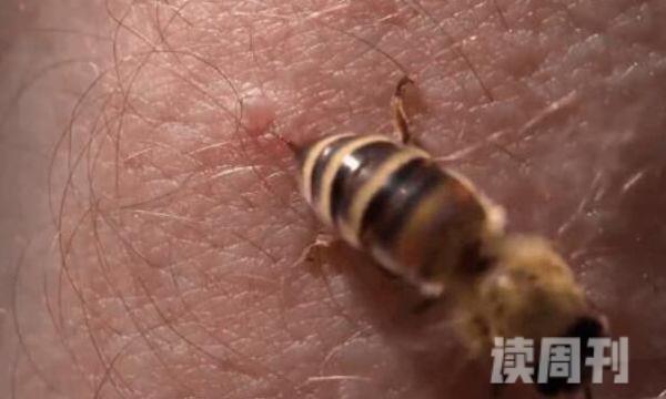 为何蜜蜂蛰人后就死掉（因为毒针和内脏是相连）(1)