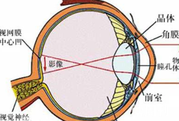 武汉大学生玩过山车致视网膜脱落（5%以上的高度近视者可发生视网膜脱离）(7)