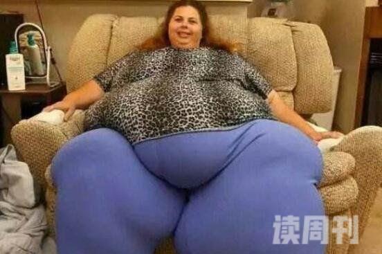 世界最胖的人图片体重1400斤（34岁时候因肾衰竭）