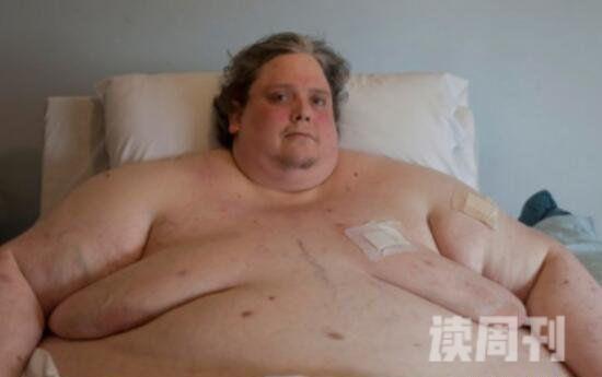 世界最胖的人图片体重1400斤（34岁时候因肾衰竭）(3)