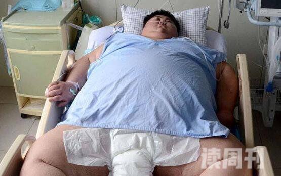 世界最胖的人图片体重1400斤（34岁时候因肾衰竭）(4)