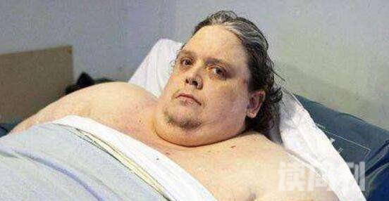 世界上最胖的男人（庞大的身躯使他每天只能在床上度日）(3)