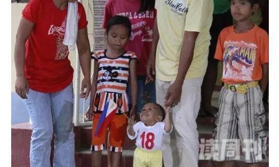 世界上最矮的人琼瑞·巴拉温两岁就停止生长（身高59.9cm）(4)