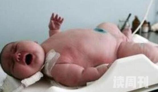 世界上最大的婴儿澳大利亚巨婴36斤(六岁儿童体重)(3)