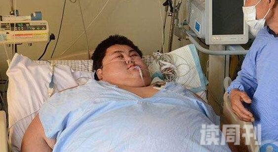 盘点中国第一胖孙亮体重600斤因肥胖猝死(图片)