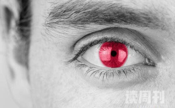 世界上最稀有瞳孔紫罗兰眼睛最美丽/红色眼睛最吓人(5)
