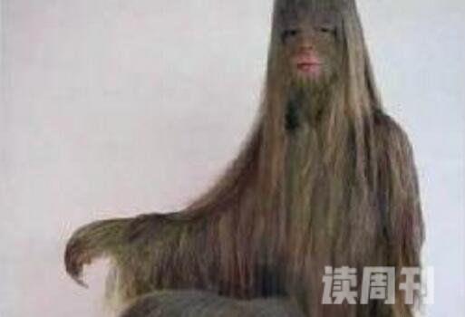 世界上体毛最长的人艾米丽·苏珊脱毛后照片曝光(返祖现象)