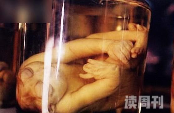 全球最恐怖博物馆美国费城马特博物馆(收藏2万具畸形尸体)(3)